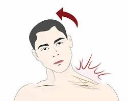 Brachial Plexus Injuries Treatment in Delhi